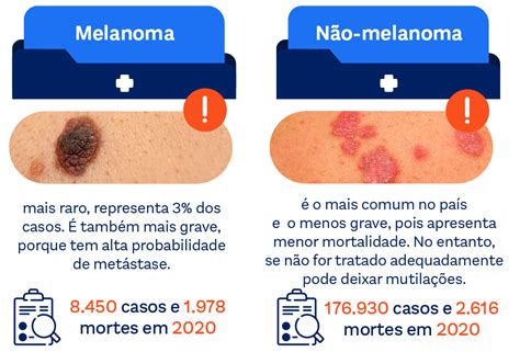 cancer de pele não melanoma